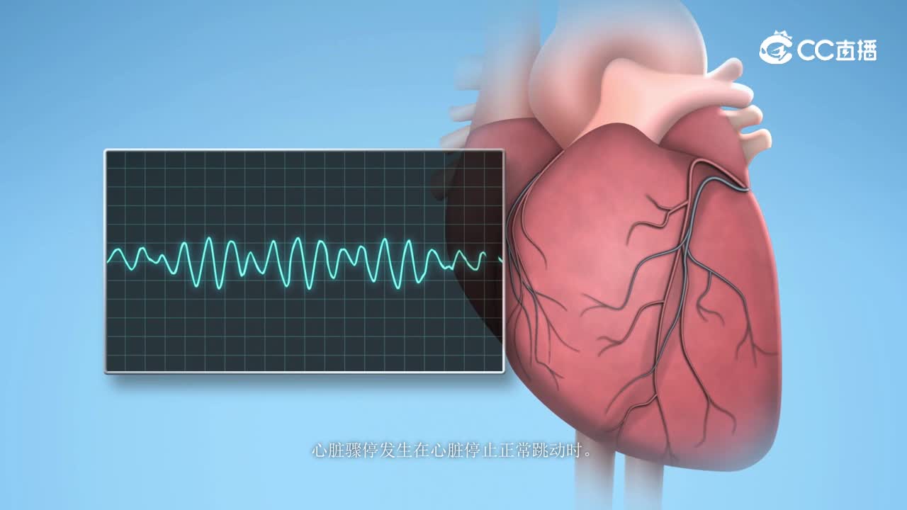 心脏骤停科普